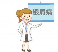 成都看牛皮癣医院哪家好